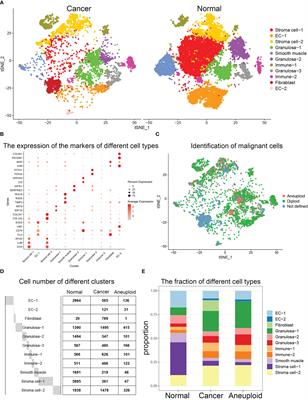 Comparative analysis between high-grade serous ovarian cancer and healthy ovarian tissues using single-cell RNA sequencing